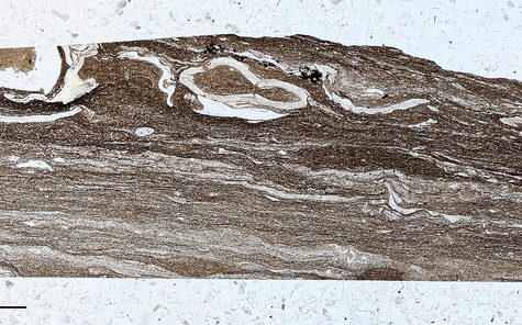 Gold and Silver in Thin Section