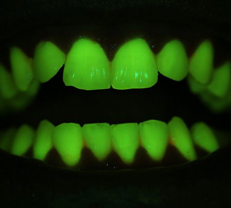 Gums Fluorescence
