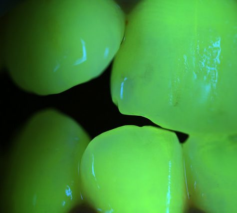 Gums Fluorescence