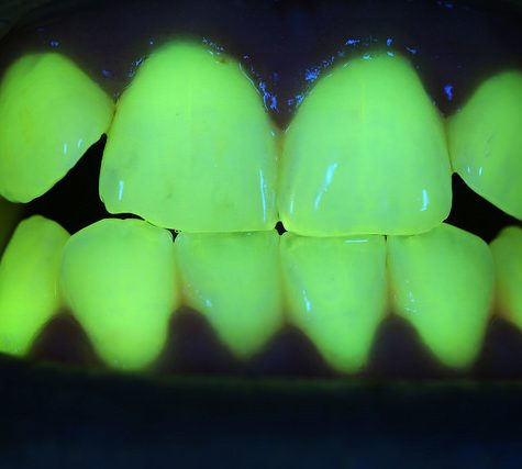 Gums Fluorescence