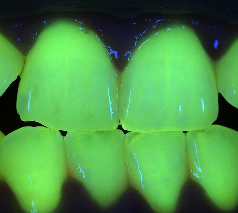 Gums Fluorescence