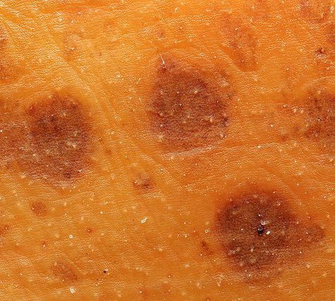 Potassium bitartrate, Cream of Tartar buildup on Wine Cork after bottling.  Otherwise called Wine Diamonds.
