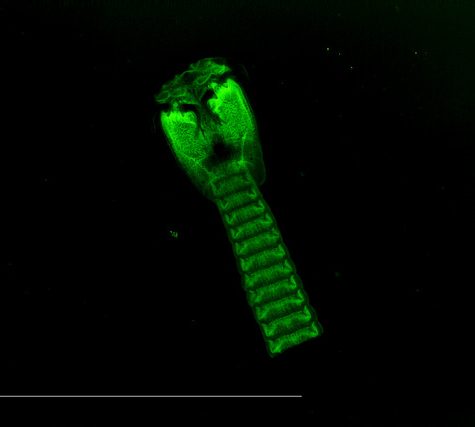 Tapeworm Parasite in Mustelus canis