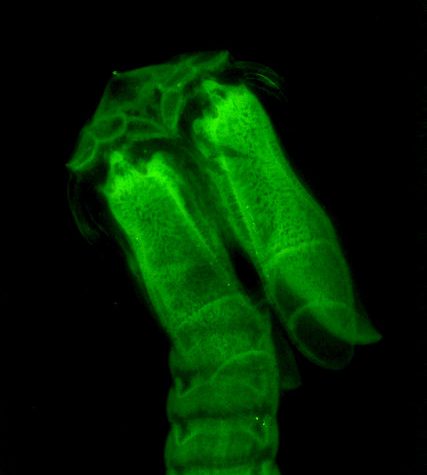 Tapeworm Parasite in Mustelus canis