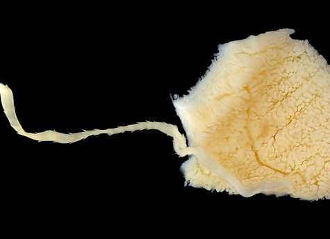 Tapeworm Parasite in Mustelus canis