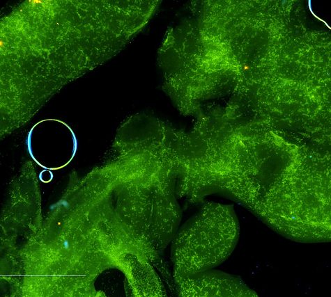 Mole, Glastonbury, CT Line St Oct 28, 2017