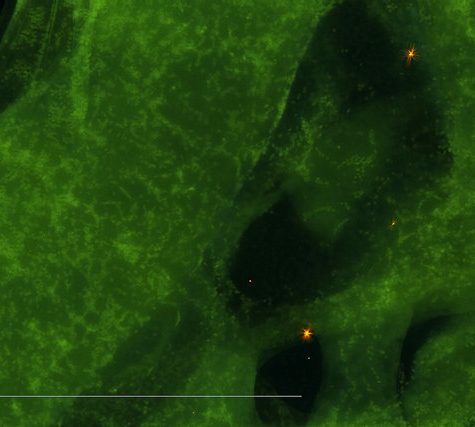 Mole, Glastonbury, CT Line St Oct 28, 2017