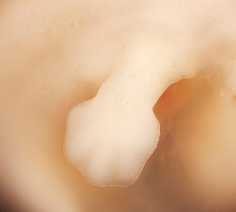 Mole, Glastonbury, CT Line St Oct 28, 2017