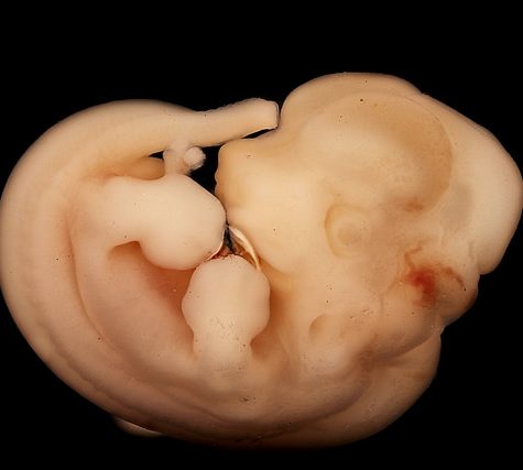 Mole, Glastonbury, CT Line St Oct 28, 2017