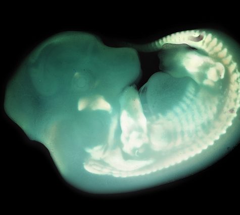 Mole, Glastonbury, CT Line St Oct 28, 2017