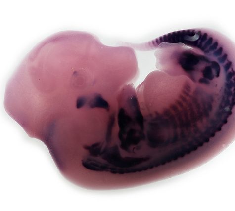 Mole, Glastonbury, CT Line St Oct 28, 2017