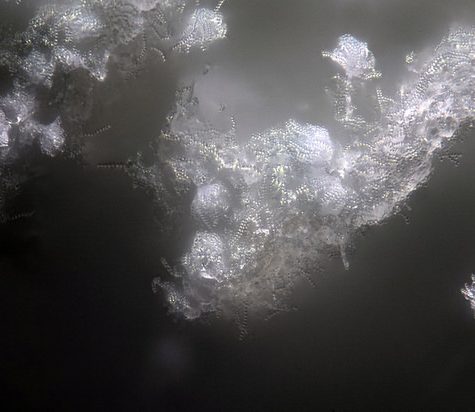 Yellow Fungus on an Ant's Abdomen releases spores, Tolland, CT