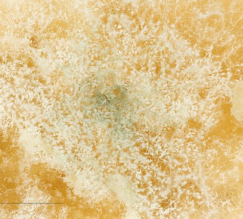 Yellow Fungus on an Ant's Abdomen releases spores, Tolland, CT